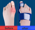 Corrector de Juanetes